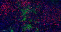 Immunofluorescence (IF): Fluorescence multiplex immunohistochemical analysis of human tonsil tissue (formalin-fixed STJ196916