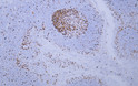 Immunohistochemistry - Paraffin (IHC-P): Human tonsil tissue was stained with Anti-MCM2 (ABT-MCM2) antibody. STJ196928