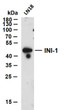 Western Blot (WB): LN18 whole cell lysates were separated by 12% SDS-PAGE, and the membrane was blotted with anti-INI-1 STJ196996