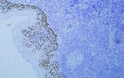 Immunohistochemistry (IHC): Human tonsil tissue was stained with Anti-p40 (ABT-P40) antibody. STJ196999