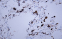 Immunohistochemistry (IHC): Human lung tissue was stained with Anti-Napsin A (ABT-ASP4) antibody. STJ197021