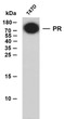 Whole cell lysates were separated by 15% SDS-PAGE, and the membrane was blotted with anti-PR (ABT-PR. 1) antibody. The HRP-conjugated Goat anti- mouse IgG (H + L) antibody was used to detect the antibody. Lane 1: T47DPredicted band size: 99kDaObserved band size: 99kDa