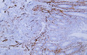 Immunohistochemistry - Paraffin (IHC-P): Human appendix tissue was stained with Anti-CD56 (ab5500) Antibody STJ197086