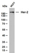 Whole cell lysates were separated by 10% SDS-PAGE, and the membrane was blotted with anti-Her-2 (ABT338) antibody. The HRP-conjugated Goat anti- mouse IgG (H + L) antibody was used to detect the antibody. Lane 1: MCF7Predicted band size: 137kDaObserved band size: 200kDa Whole cell lysates were separated by 10% SDS-PAGE, and the membrane was blotted with anti-Her-2 (ABT338) antibody. The HRP-conjugated Goat anti- mouse IgG (H + L) antibody was used to detect the antibody. Lane 1: MCF7Predicted band size: 137kDaObserved band size: 200kDa