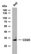 Raji whole cell lysates were separated by 10% SDS-PAGE, and the membrane was blotted with anti-CD20 (ABT065) antibody. The HRP-conjugated Goat anti- mouse IgG (H + L) antibody was used to detect the antibody. Lane 1: RajiPredicted band size: 33kDaObserved band size: 33kDa