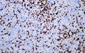 Human lymphoma tissue was stained with Anti-CD7 (ABT035) Antibody