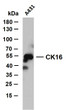 A431 whole cell lysates were separated by 10% SDS-PAGE, and the membrane was blotted with anti-CK16 (ABT059) antibody. The HRP-conjugated Goat anti- mouse IgG (H + L) antibody was used to detect the antibody. Lane 1: A431Predicted band size: 51kDaObserved band size: 55kDa