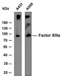 Various whole cell lysates were separated by 10% SDS-PAGE, and the membrane was blotted with anti-Factor XIIIa antibody. The HRP-conjugated anti- mouse IgG antibody was used to detect the antibody. Predicted band size: 83 kDa