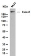Whole cell lysates were separated by 10% SDS-PAGE, and the membrane was blotted with anti-Her-2 (ABT088) antibody. The HRP-conjugated Goat anti- mouse IgG (H + L) antibody was used to detect the antibody. Lane 1: MCF7Predicted band size: 137kDaObserved band size: 200kDa