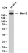 Whole cell lysates were separated by 10% SDS-PAGE, and the membrane was blotted with anti-Her-2 (ABT088) antibody. The HRP-conjugated Goat anti- mouse IgG (H + L) antibody was used to detect the antibody. Lane 1: SK-BR-3Predicted band size: 137kDaObserved band size: 200kDa