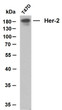 Whole cell lysates were separated by 10% SDS-PAGE, and the membrane was blotted with anti-Her-2 (ABT008) antibody. The HRP-conjugated Goat anti- mouse IgG (H + L) antibody was used to detect the antibody. Lane 1: T47DPredicted band size: 137kDaObserved band size: 180kDa
