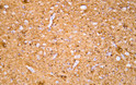 Human cerebrum tissue was stained with Anti-Neurofilament (ABT356) Antibody