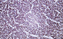 Human hippocampus tissue was stained with Anti-Neurofilament (ABT356) Antibody