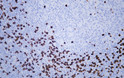 Human tonsil tissue was stained with Anti-CD8 (ABT304) Antibody