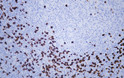 Immunohistochemistry - Paraffin (IHC-P): Human tonsil tissue was stained with anti-CD8 (ABT304) antibody. STJ197218