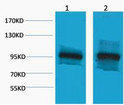 Western blot analysis of 1) 3T3, 2) Rat Liver, diluted at 1:2,000. Secondary antibody (STJ99666) was diluted at 1:20000