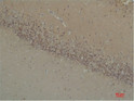 Immunohistochemical analysis of paraffin-embedded Rat Brain Tissue using BAI1 Rabbit pAb diluted at 1:200.