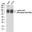 Various whole cell lysates were separated by 10% SDS-PAGE, and the membrane was blotted with anti-Lamin A/C (Phospho-Ser392) (PTR1133) antibody. The HRP-conjugated Goat anti- mouse IgG (H + L) antibody was used to detect the antibody. Lane 1: A549 Lane 2: LN18Predicted band size: 63, 74kDaObserved band size: 63, 74kDa