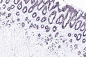 Human stoamch tissue was stained with MUC5AC (ABT302) Antibody