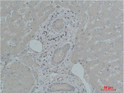 Immunohistochemical analysis of paraffin-embedded Human Liver Tissue using TF Polyclonal Antibody.