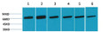 Western blot analysis of 1) Hela, 2) HepG2, 3) Raw, 4) Mouse Brain, 5) Rat Brain, 6) Rat Liver using HSC 70 Polyclonal Antibody. Secondary antibody (STJ99666) was diluted at 1:20000