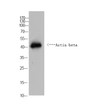 Western Blot analysis of C. elegans cells using Actin beta rabbit pAb (Caenorhabditis elegans). Secondary antibody (STJ99666) was diluted at 1:20000