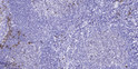 Immunohistochemical analysis of paraffin-embedded human tonsil. 1, Antibody was diluted at 1:200 (4°C overnight). 2, Tris-EDTA, pH9.0 was used for antigen retrieval. 3, Secondary antibody was diluted at 1:200 (room temperature, 45min).