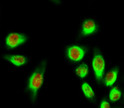 Immunofluorescence analysis of HeLa cells. 1, E2F-1 Antibody (red) was diluted at 1:200 (4°C overnight). HER2 STJA0006907