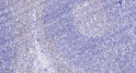 Immunohistochemical analysis of paraffin-embedded human tonsil. 1, Antibody was diluted at 1:200 (4°C overnight). 2, Tris-EDTA, pH9.0 was used for antigen retrieval. 3, Secondary antibody was diluted at 1:200 (room temperature, 45min).