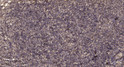 Immunohistochemical analysis of paraffin-embedded human uterus. 1, Antibody was diluted at 1:200 (4°C overnight). 2, Tris-EDTA, pH9.0 was used for antigen retrieval. 3, Secondary antibody was diluted at 1:200 (room temperature, 45min).