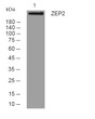 Western blot analysis of lysates from VEC cells, primary antibody was diluted at 1:1000, 4°C over night