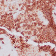 Anti-CD99 antibody IHC STJ180638