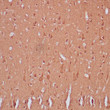 Human cerebellum stained with anti-NSE antibody using peroxidase-conjugate and DAB chromogen. Note cytoplasmic staining of neuronal cells. Human cerebellum stained with anti-NSE antibody using peroxidase-conjugate and DAB chromogen. Note cytoplasmic staining of neuronal cells.