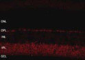 IHC staining retinal tissue with antibody Shank protein localization at 40X STJA0005705