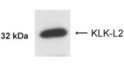Western Blot analysis BT-474 cell lysate detecting Kallikrein 5 protein STJA0005730