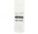 Western Blot ESDN-DCBLD2 immunolabeling in transfected 293T cells STJA0005741