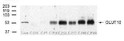 Western Blot GLUT10 immunolabeling in liver and cochlea protein samples STJA0005777