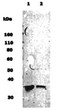 Western Blot Musashi-1 immunolabeling in rat neural stem cell and human brain lysates STJA0005789