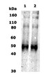 Western Blot Kappa Opioid Receptor immunolabeling in human and rat brain lysates STJA0005799