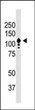 Western Blot CD133 immunolabeling in Y79 cells at 120 kDa STJA0005810