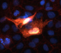 anti-beta-catenin antibody IHC staining in transfected COS-7 cells with DAPI counterstain STJA0005235