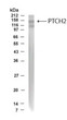 Western Blot specific PTCH2 immunolabeling in human fetal brain lysate STJA0005680