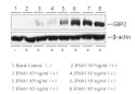 Human IFN-alpha 1/13 (Q114A) protein (Recombinant) (C-His) (STJP000785)