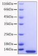 Human CCL7/MCP-3 protein (Recombinant) (No tag) (STJP000839)