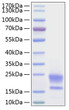 Human WAP5/WFDC2/HE4 protein (Recombinant) (C-His) (STJP000908)