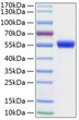 Human uPA/PLAU protein (Recombinant) (C-His) (STJP000921)