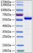 Human Ephrin-A5/EFNA5 protein (Recombinant) (C-hFc&His) (STJP000951)