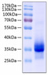 Human IGFBP-4 protein (Recombinant) (C-His) (STJP000959)