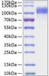 Human EGFR protein (Active Recombinant) (C-His) (STJP000982)