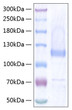 Human Thrombospondin-5/COMP protein (Recombinant) (C-His) (STJP001026)